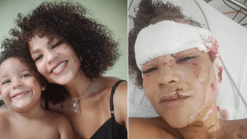 Gíbia, sobrevivente de tentativa de feminicídio, que precisa de apoio para recomeçar